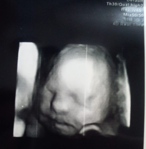 Zdjęcie twarzy dziecka z USG